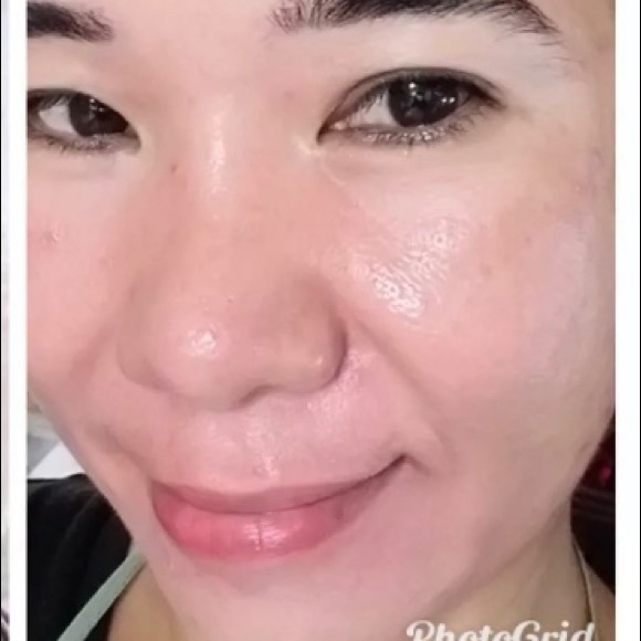 roswinda melasma soap